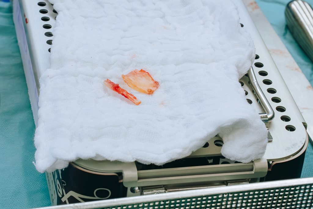 2025 10 06 Ortopedia Blok Operacyjny sala nr 3 nr 099