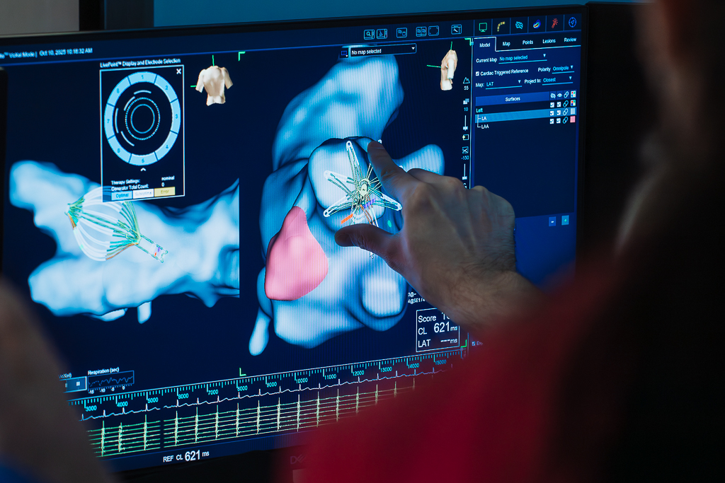 2025 10 10 Elektrokardiologia nr 11