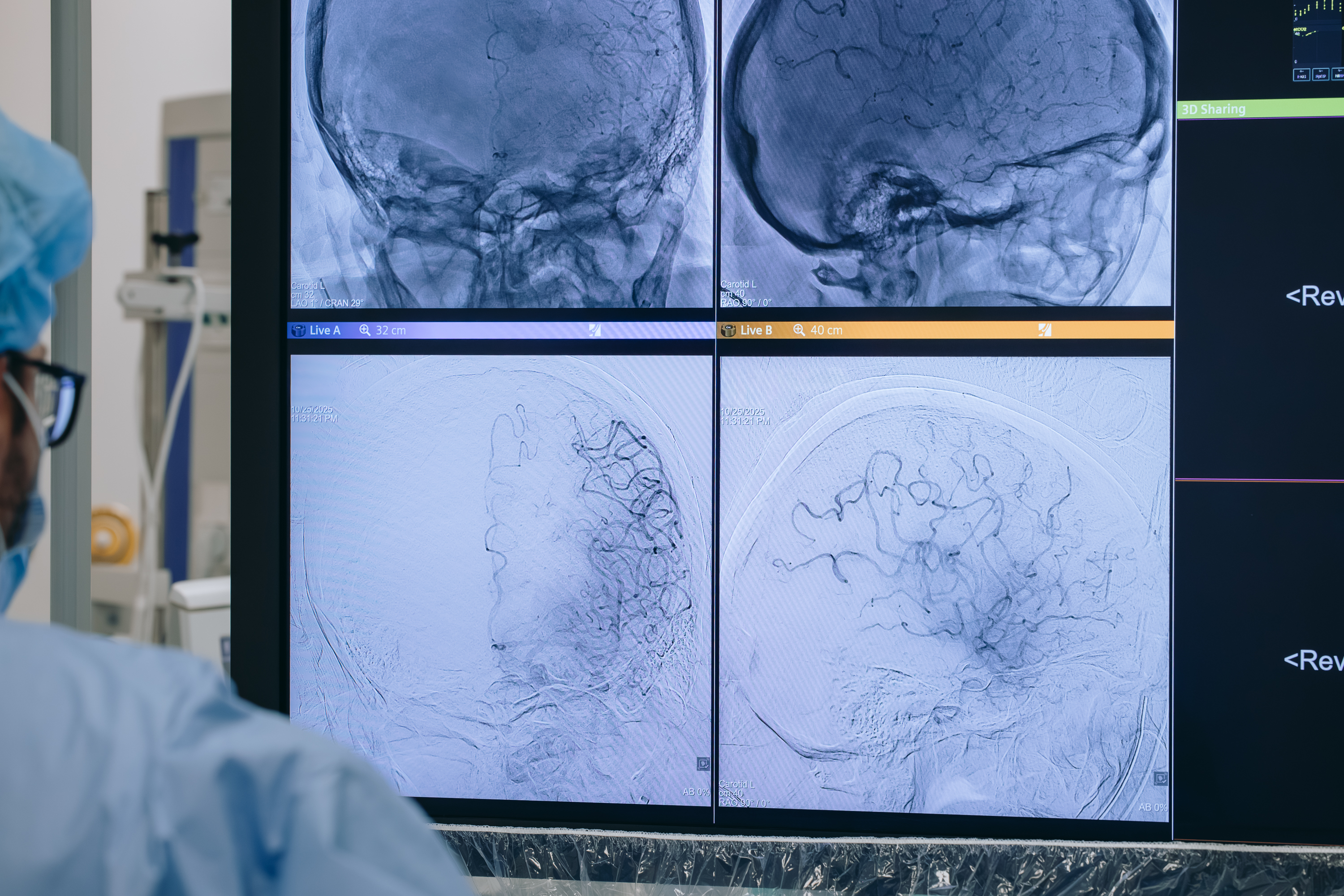 USK Nr 4 w Lublinie z prestiżową nagrodą za najlepszą opiekę nad pacjentami z udarem